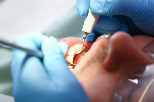 Best Dentist for Severe Toothache  in Oak Trail Shores, TX